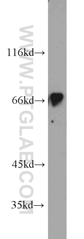 Western Blot (WB) analysis of mouse kidney tissue using IFT81 Polyclonal antibody (10604-2-AP)