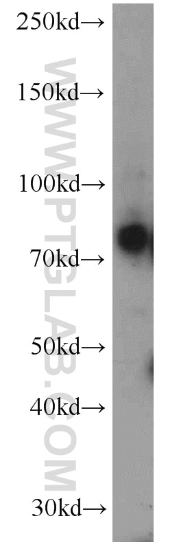 Western Blot (WB) analysis of HEK-293 cells using IFT81 Polyclonal antibody (10604-2-AP)