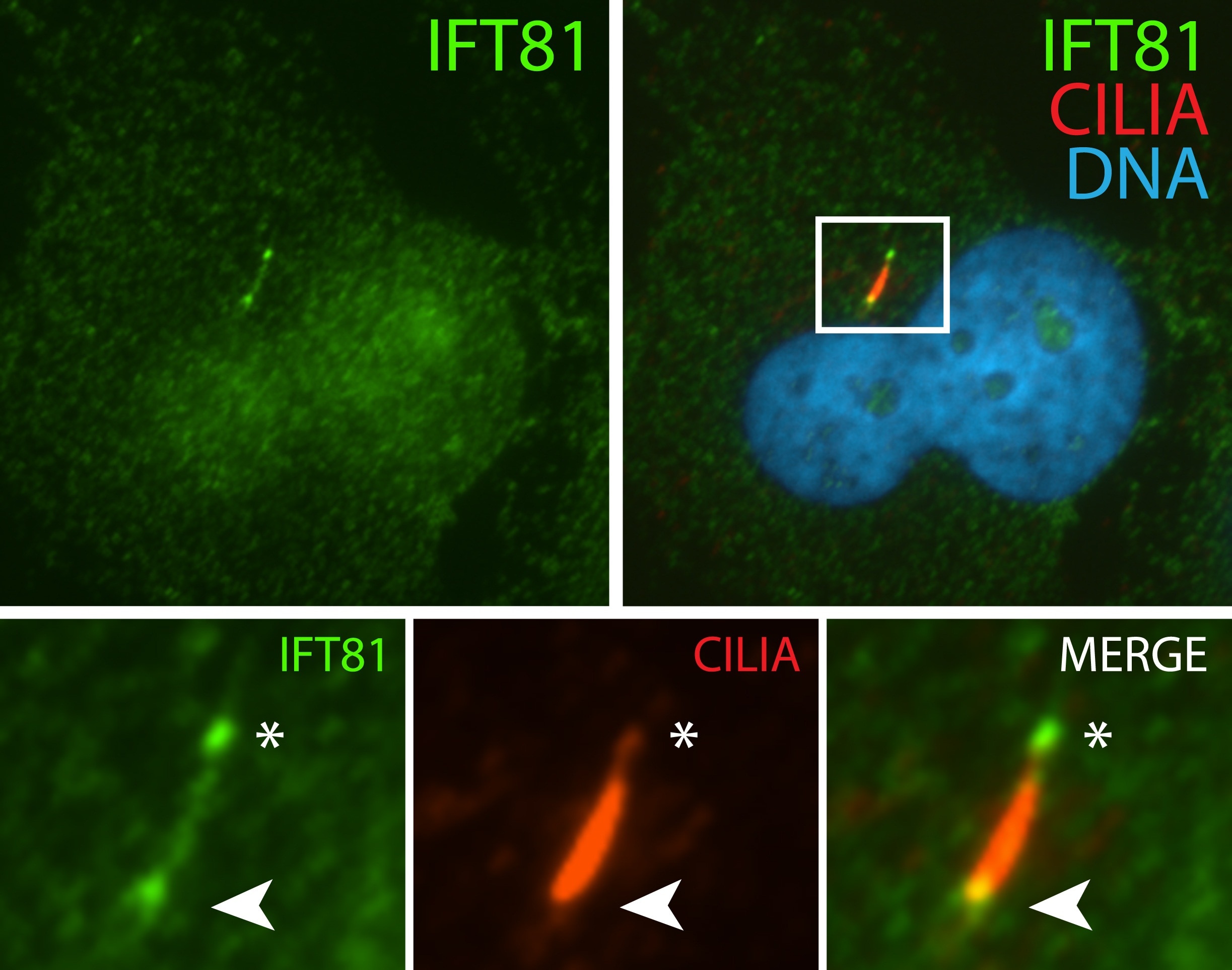 Immunofluorescence (IF) / fluorescent staining of hTERT-RPE1 cells using IFT81 Polyclonal antibody (11744-1-AP)