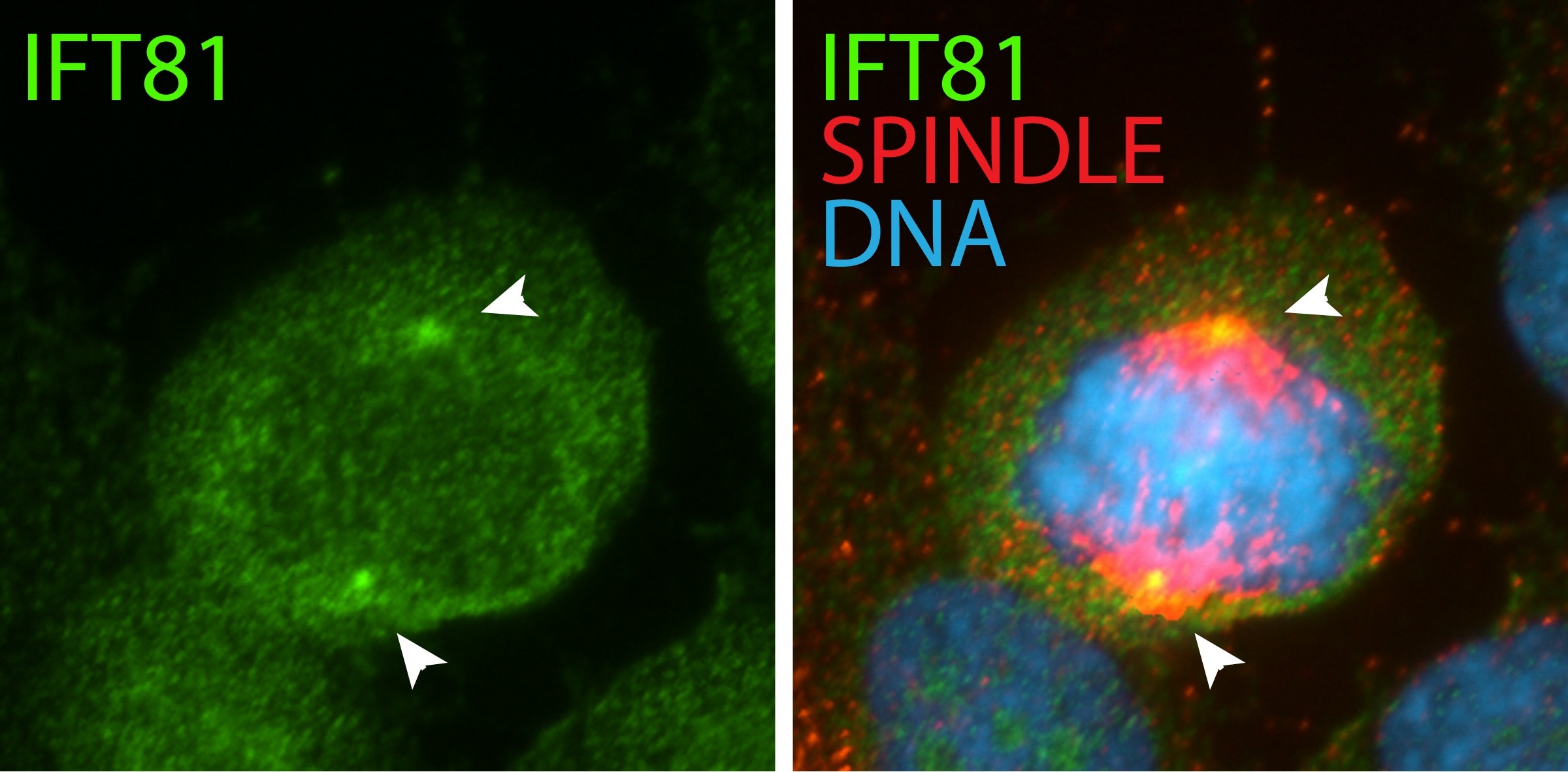 Immunofluorescence (IF) / fluorescent staining of hTERT-RPE1 cells using IFT81 Polyclonal antibody (11744-1-AP)