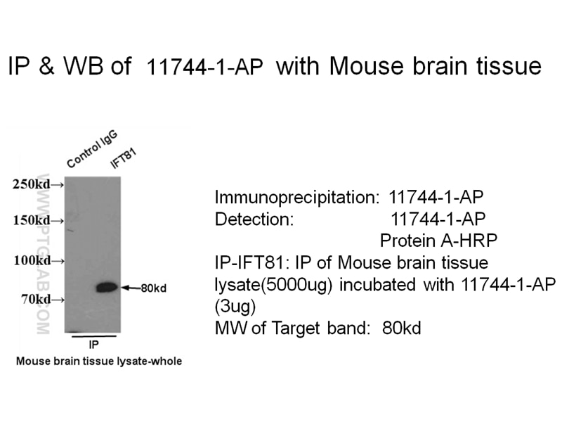 IFT81