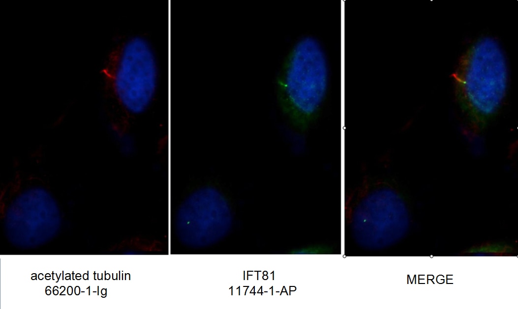 Immunofluorescence (IF) / fluorescent staining of MDCK cells using IFT81 Polyclonal antibody (11744-1-AP)