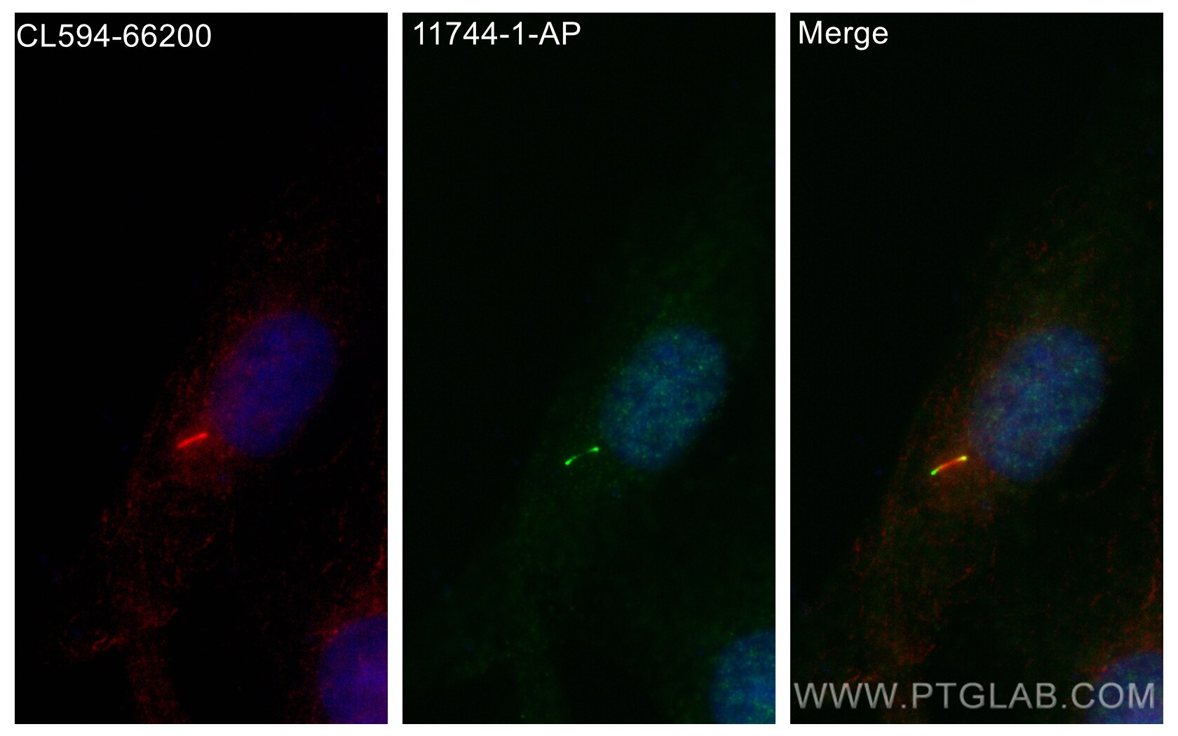 IF Staining of MDCK using 11744-1-AP