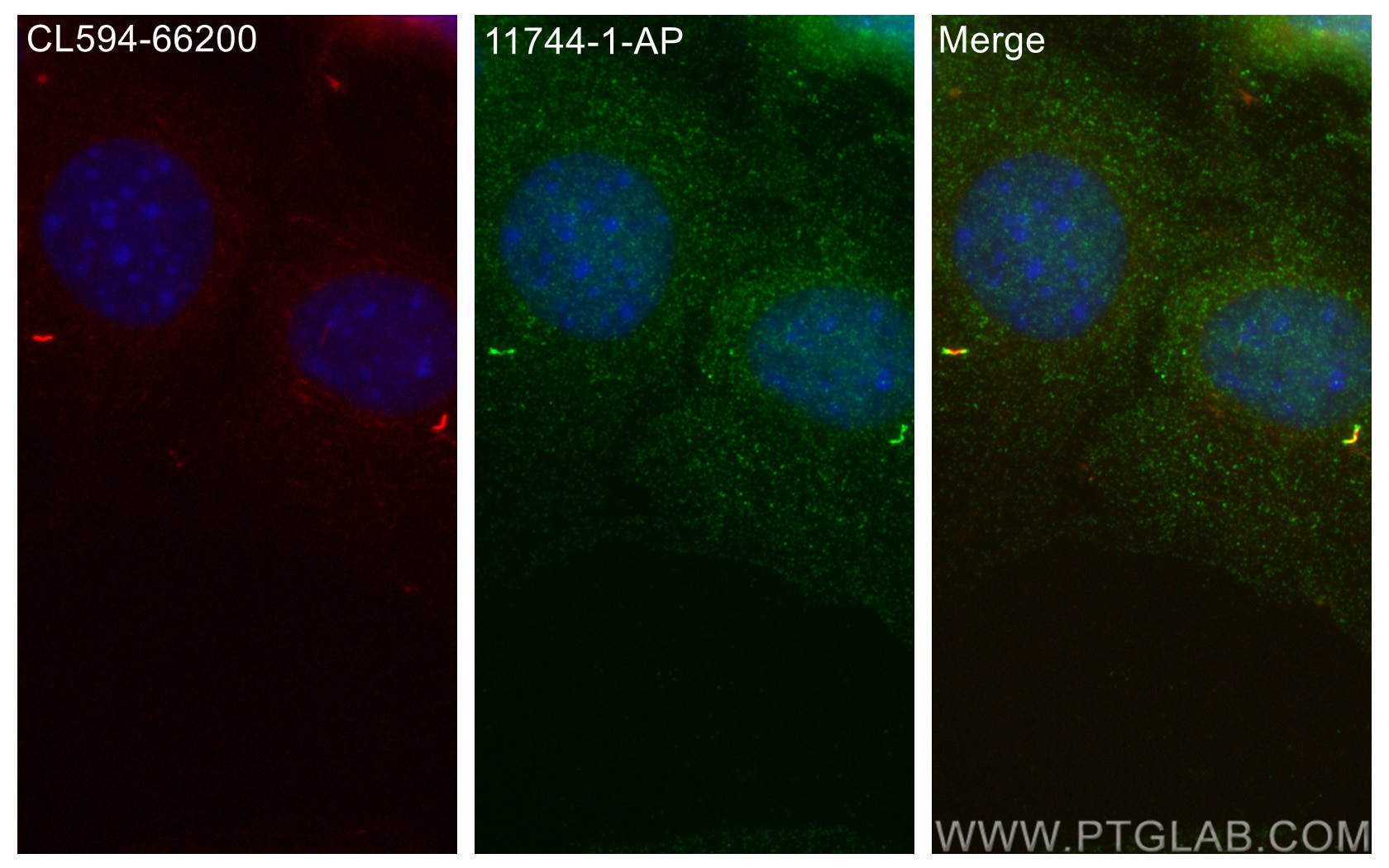 Immunofluorescence (IF) / fluorescent staining of C2C12 cells using IFT81 Polyclonal antibody (11744-1-AP)