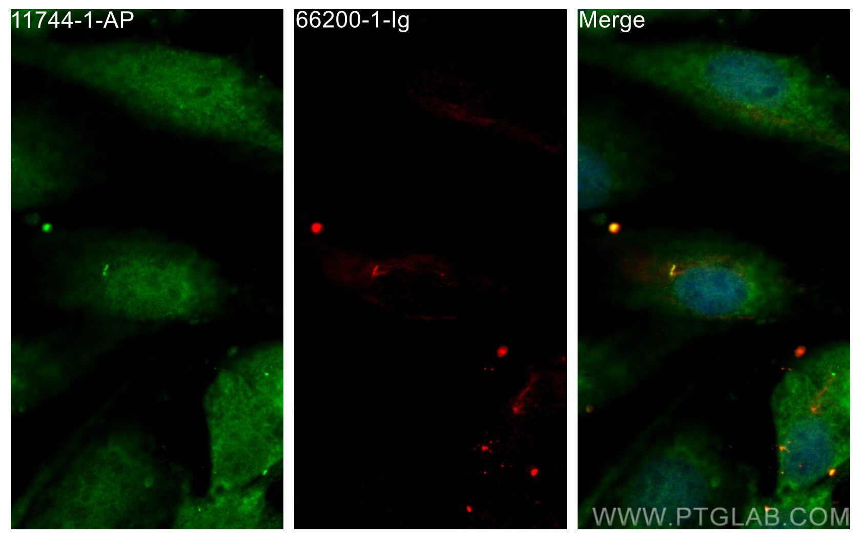 Immunofluorescence (IF) / fluorescent staining of MDCK cells using IFT81 Polyclonal antibody (11744-1-AP)