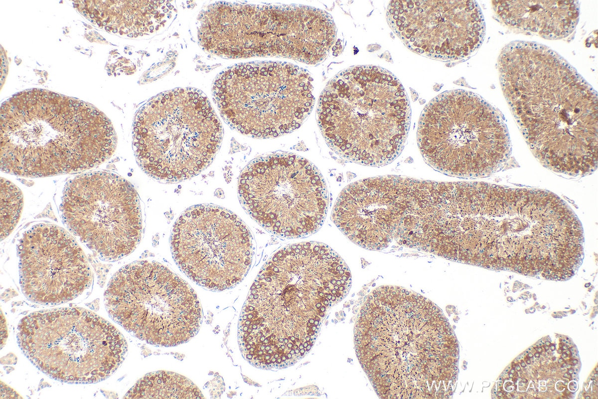 Immunohistochemistry (IHC) staining of mouse testis tissue using IFT81 Polyclonal antibody (11744-1-AP)