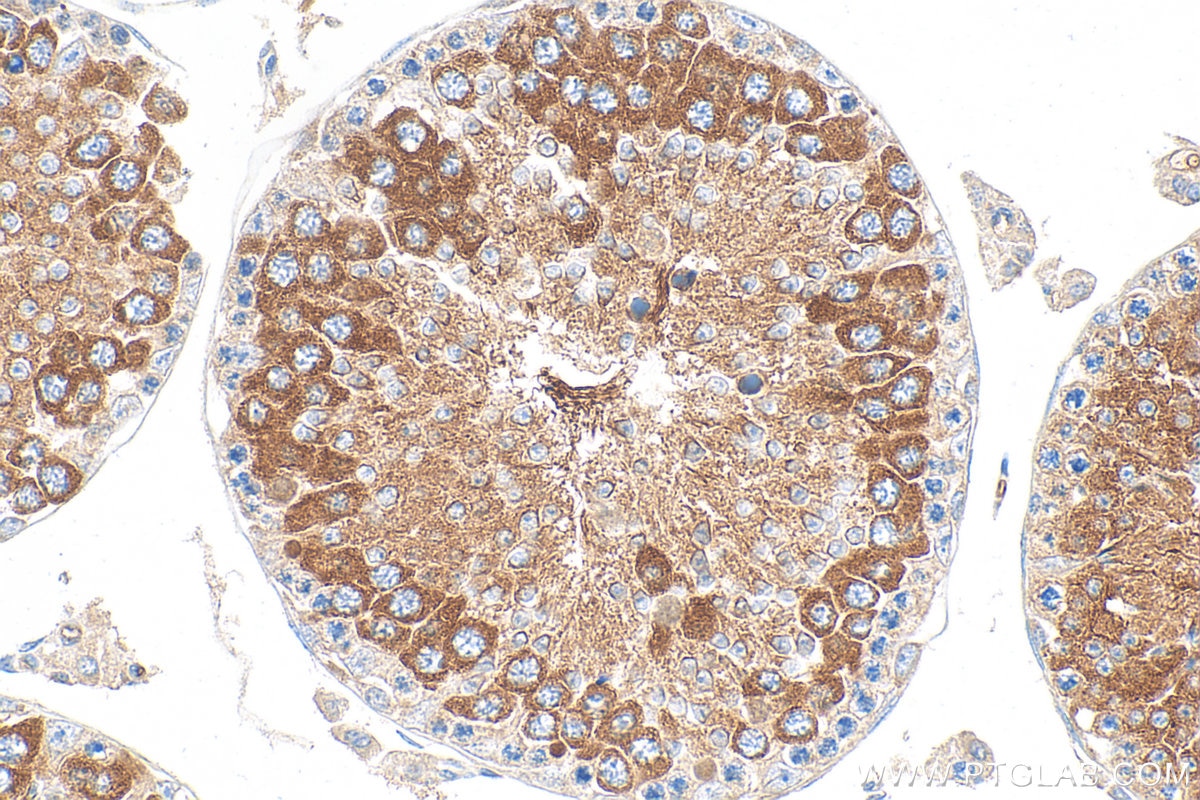 Immunohistochemistry (IHC) staining of mouse testis tissue using IFT81 Polyclonal antibody (11744-1-AP)
