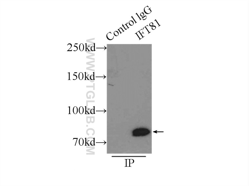 Immunoprecipitation (IP) experiment of mouse brain tissue using IFT81 Polyclonal antibody (11744-1-AP)