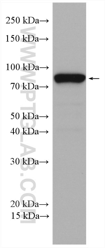 Western Blot (WB) analysis of mouse testis tissue using IFT81 Polyclonal antibody (11744-1-AP)