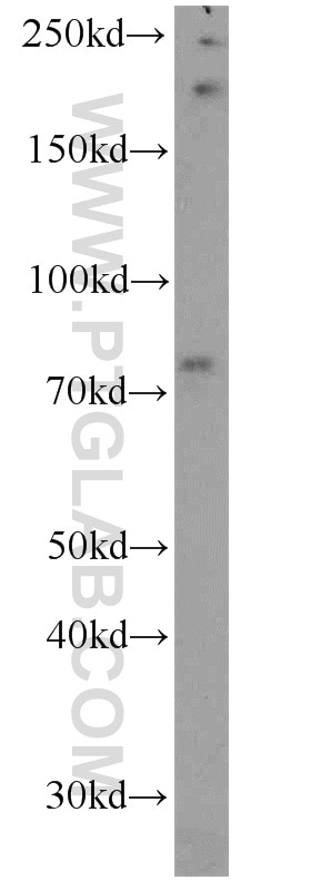 Western Blot (WB) analysis of HEK-293 cells using IFT81 Polyclonal antibody (11744-1-AP)