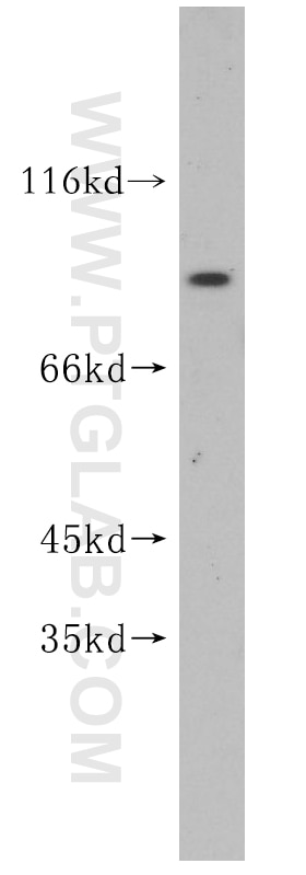 Western Blot (WB) analysis of human brain tissue using IFT81 Polyclonal antibody (11744-1-AP)