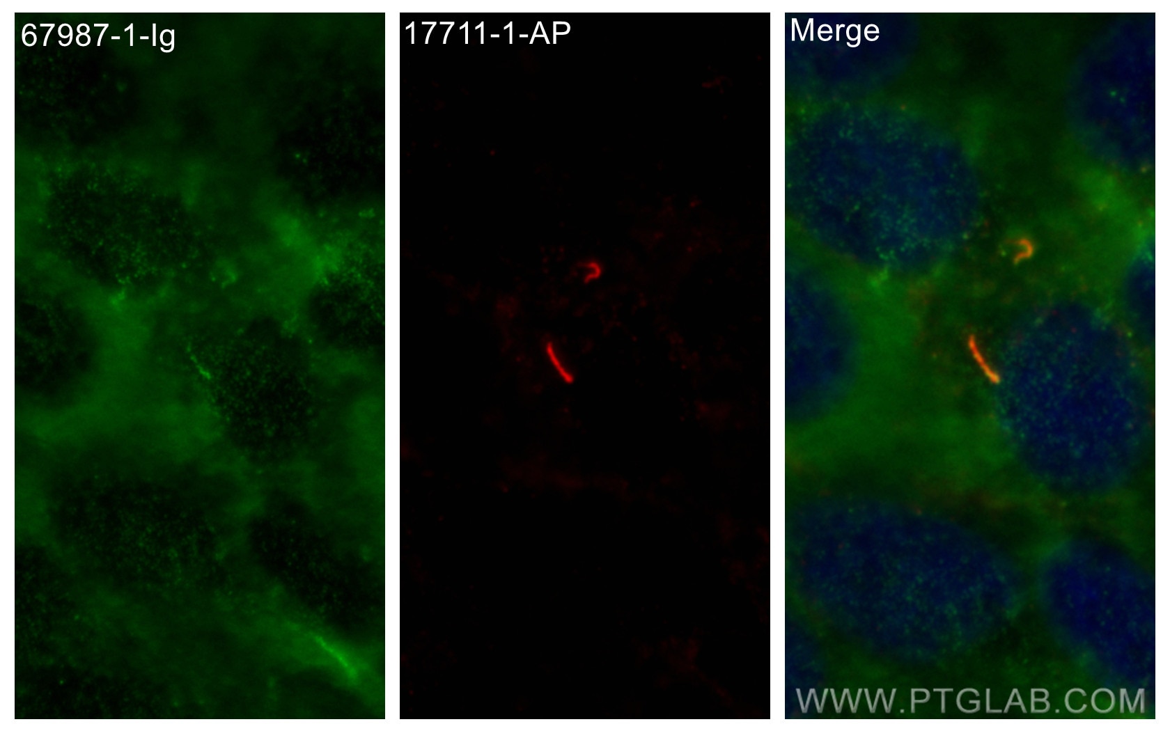 Immunofluorescence (IF) / fluorescent staining of hTERT-RPE1 cells using IFT81 Monoclonal antibody (67987-1-Ig)