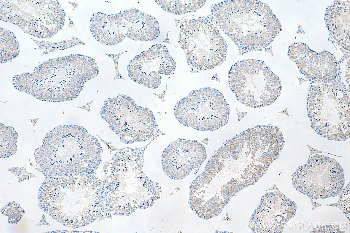 Immunohistochemistry (IHC) staining of mouse testis tissue using IFT81 Monoclonal antibody (67987-1-Ig)