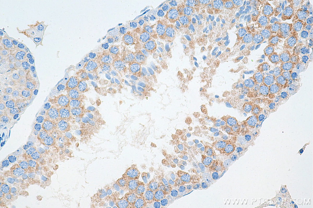 Immunohistochemistry (IHC) staining of mouse testis tissue using IFT81 Monoclonal antibody (67987-1-Ig)