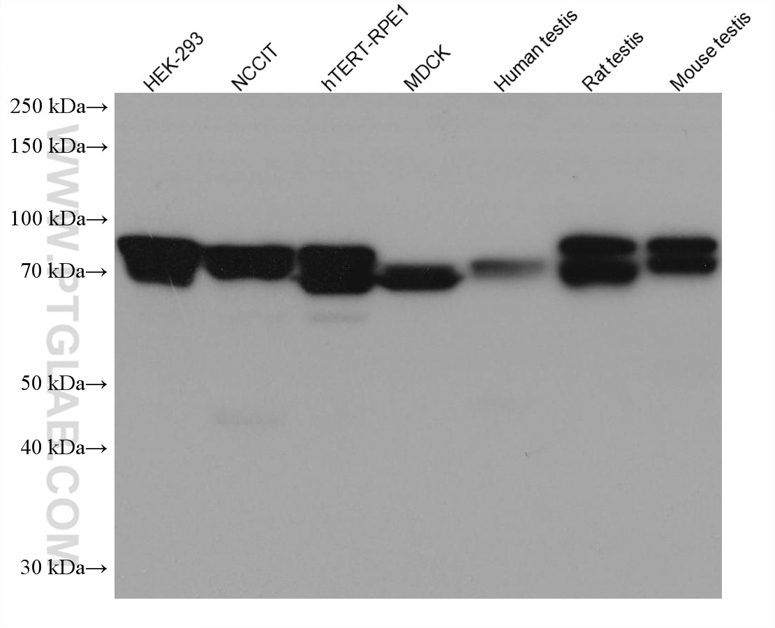 Western Blot (WB) analysis of various lysates using IFT81 Monoclonal antibody (67987-1-Ig)