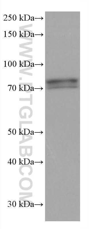 Western Blot (WB) analysis of rabbit brain tissue using IFT81 Monoclonal antibody (67987-1-Ig)