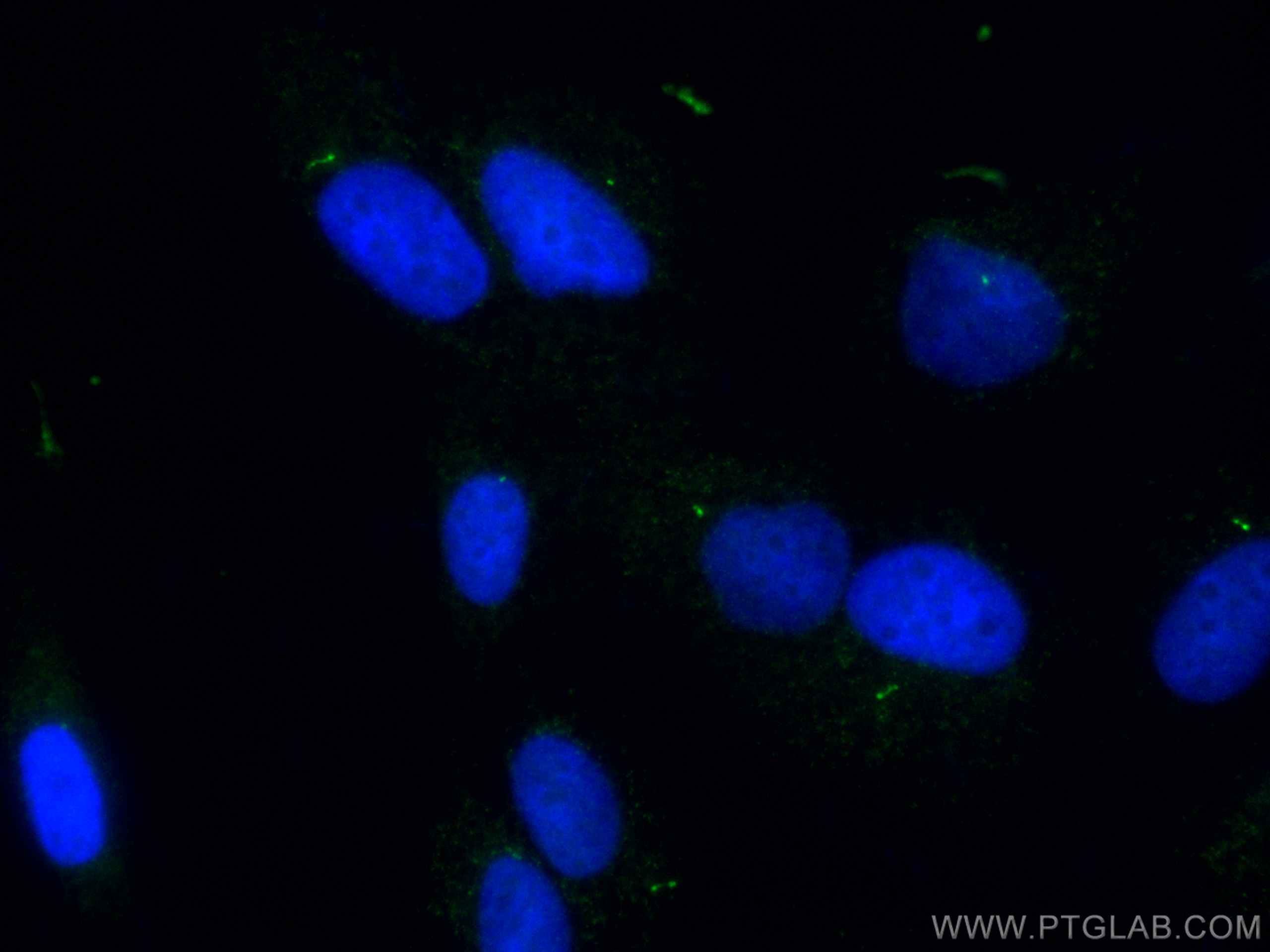 Immunofluorescence (IF) / fluorescent staining of MDCK cells using CoraLite®488-conjugated IFT81 Polyclonal antibody (CL488-11744)