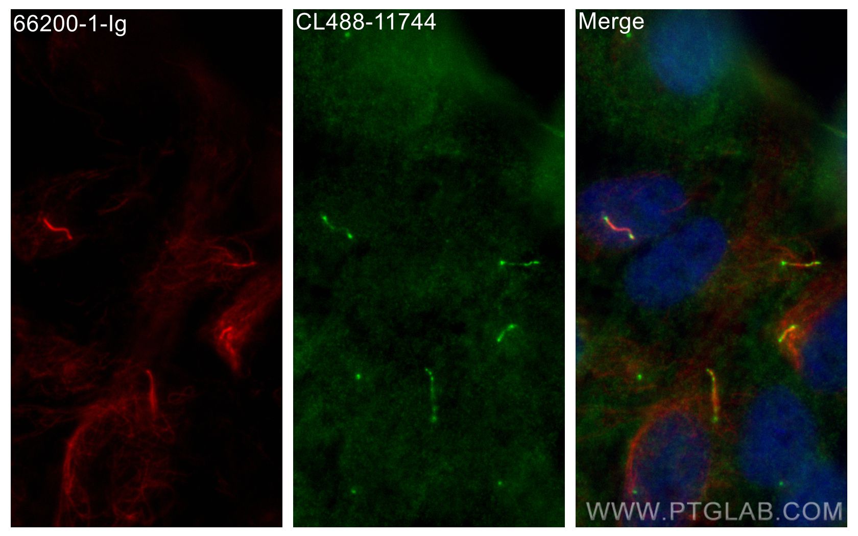 Immunofluorescence (IF) / fluorescent staining of hTERT-RPE1 cells using CoraLite® Plus 488-conjugated IFT81 Polyclonal ant (CL488-11744)