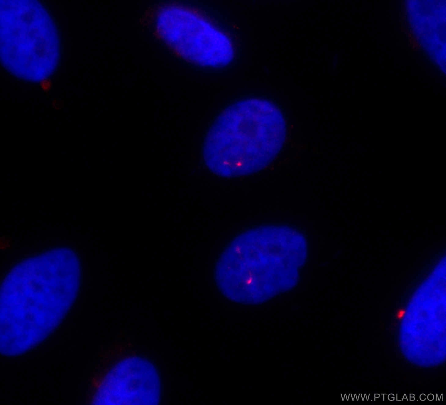 Immunofluorescence (IF) / fluorescent staining of MDCK cells using CoraLite®594-conjugated IFT81 Polyclonal antibody (CL594-11744)