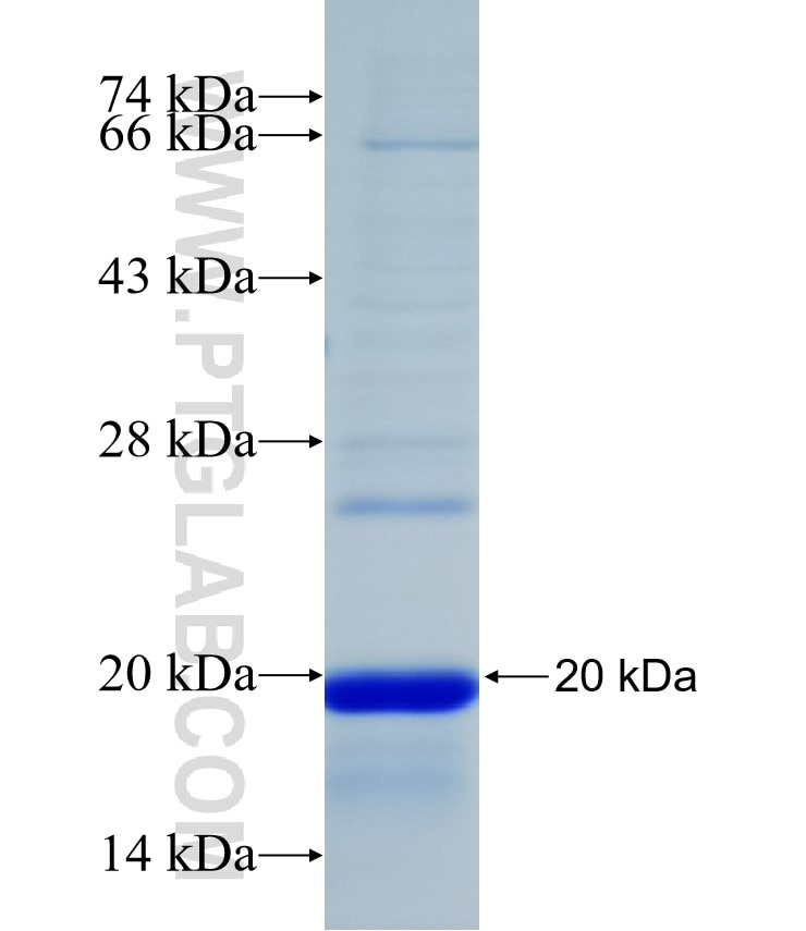 IFT81 fusion protein Ag31629 SDS-PAGE
