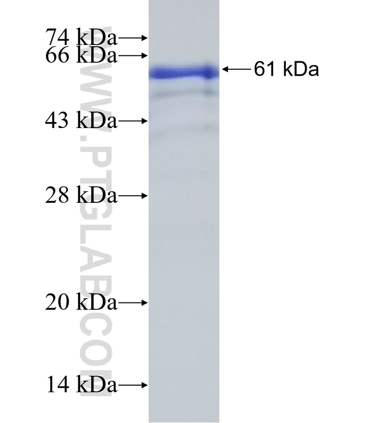 IFT81 fusion protein Ag0870 SDS-PAGE