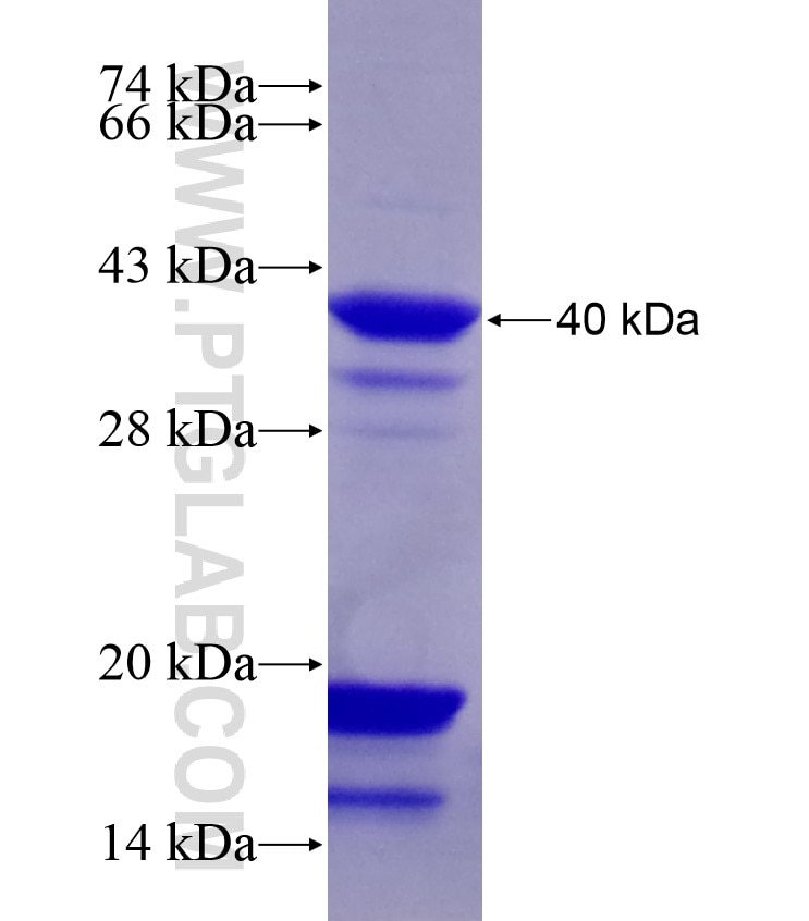 IFT81 fusion protein Ag17781 SDS-PAGE