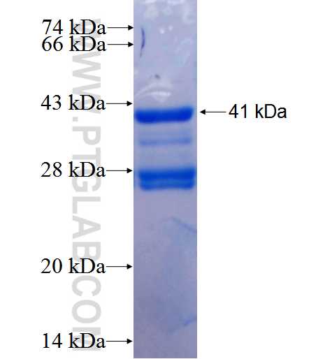 IFT81 fusion protein Ag2339 SDS-PAGE