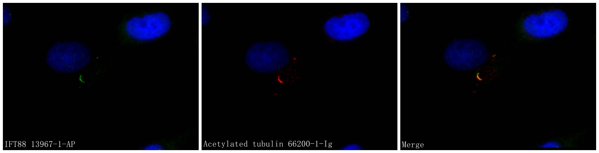 Immunofluorescence (IF) / fluorescent staining of MDCK cells using IFT88 Polyclonal antibody (13967-1-AP)