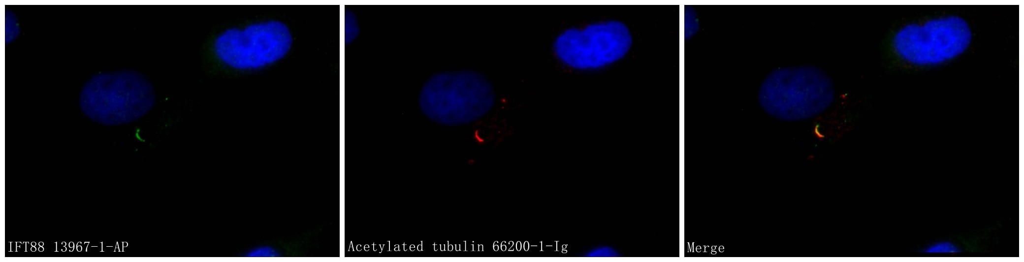 IF Staining of MDCK using 13967-1-AP