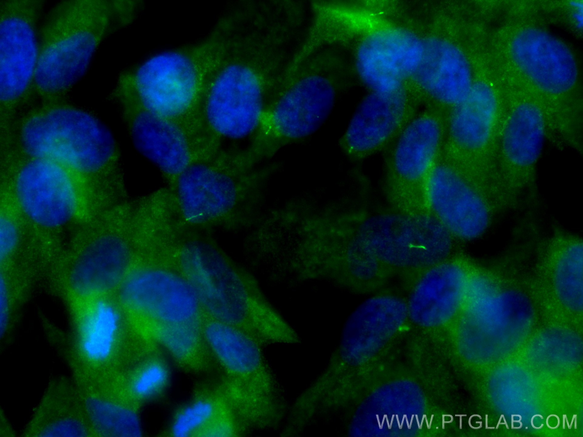 Immunofluorescence (IF) / fluorescent staining of hTERT-RPE1 cells using IFT88 Polyclonal antibody (13967-1-AP)