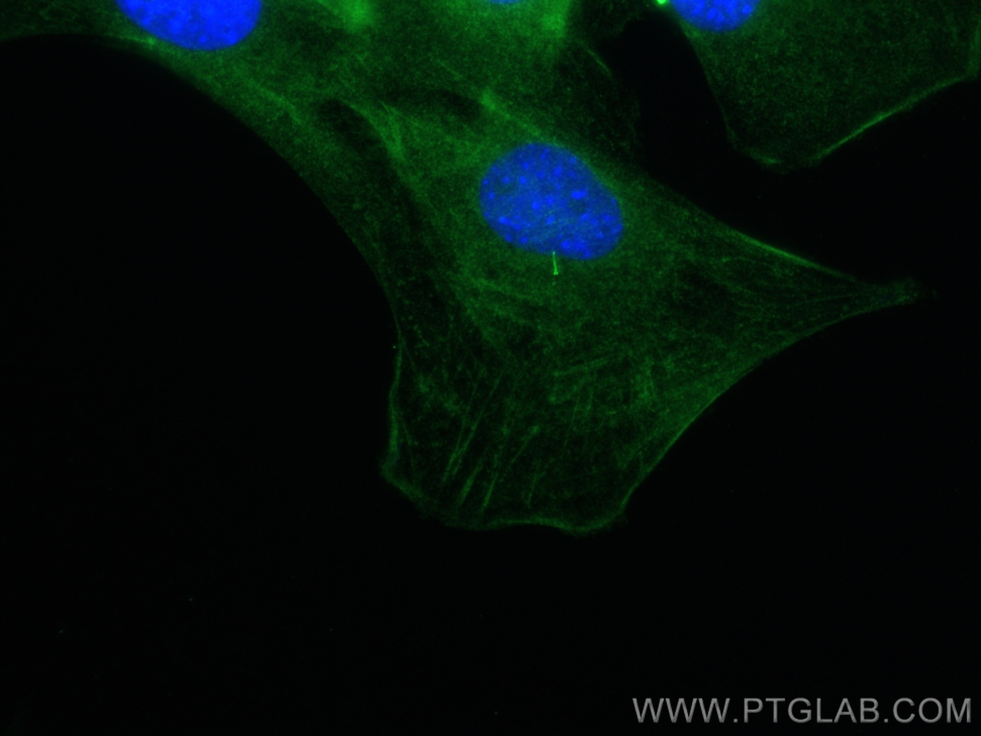 Immunofluorescence (IF) / fluorescent staining of C2C12 cells using IFT88 Polyclonal antibody (13967-1-AP)