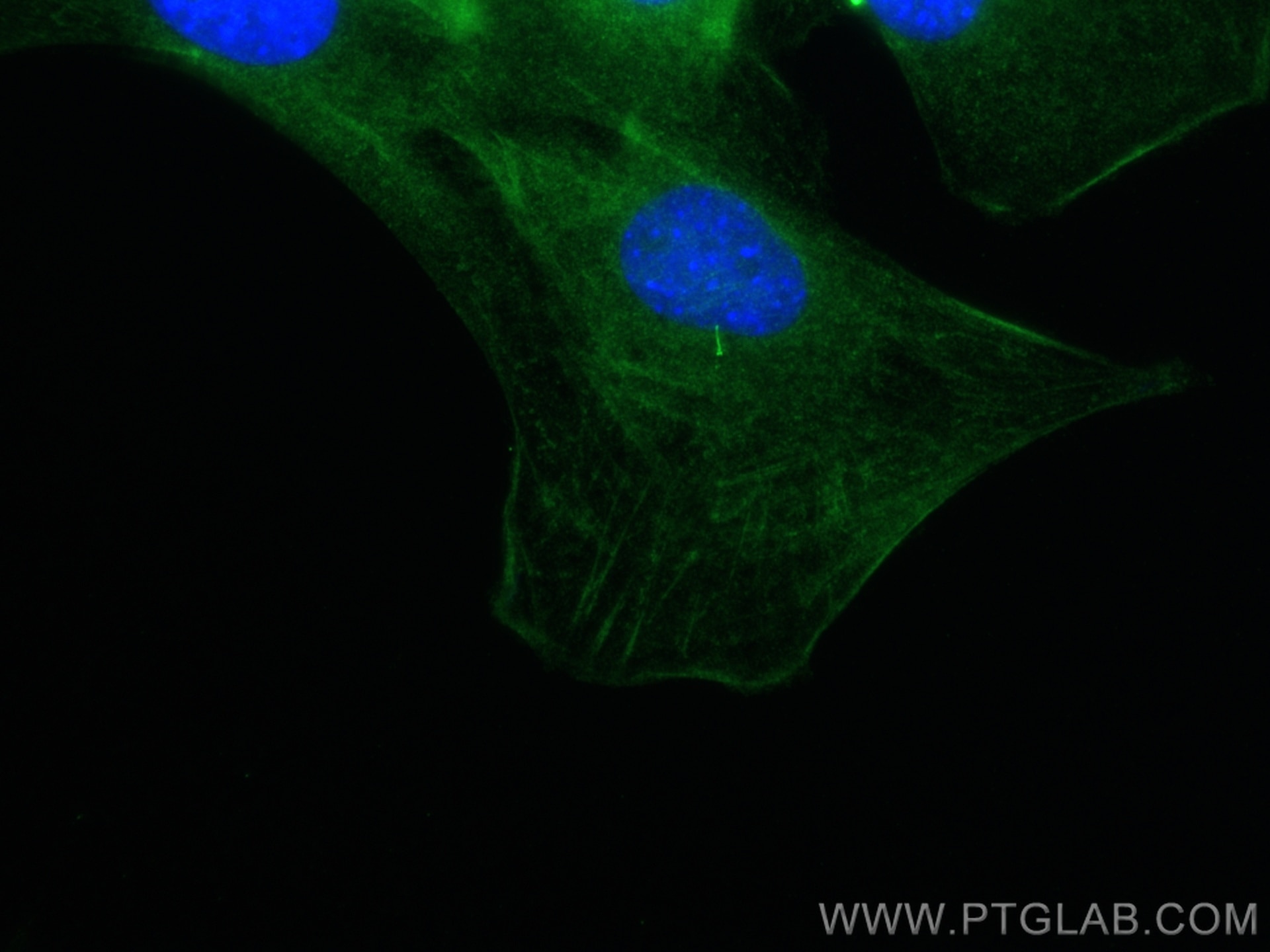 IF Staining of C2C12 using 13967-1-AP