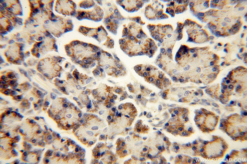 Immunohistochemistry (IHC) staining of human pancreas tissue using IFT88 Polyclonal antibody (13967-1-AP)