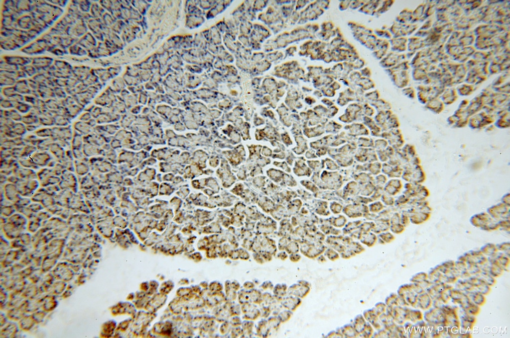 Immunohistochemistry (IHC) staining of human pancreas tissue using IFT88 Polyclonal antibody (13967-1-AP)