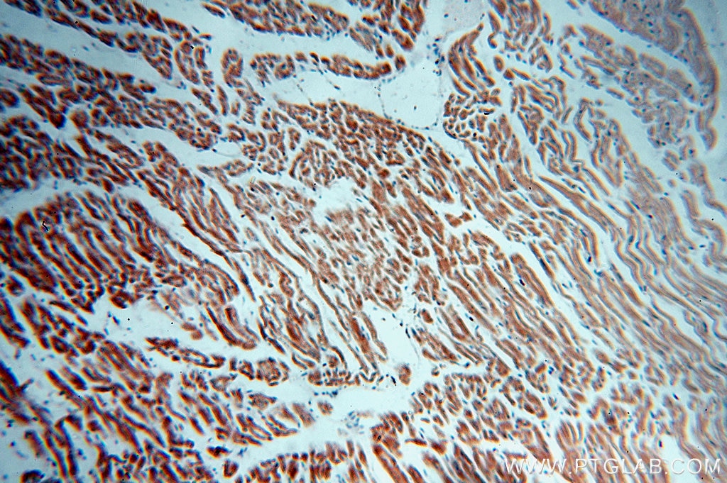 Immunohistochemistry (IHC) staining of human heart tissue using IFT88 Polyclonal antibody (13967-1-AP)