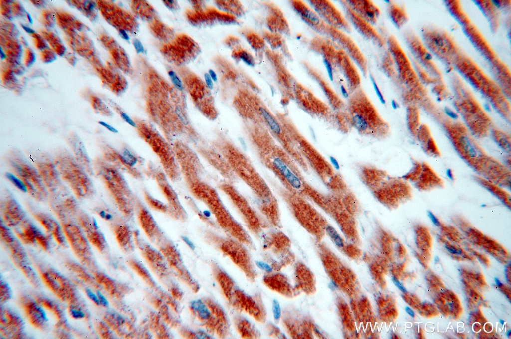 Immunohistochemistry (IHC) staining of human heart tissue using IFT88 Polyclonal antibody (13967-1-AP)