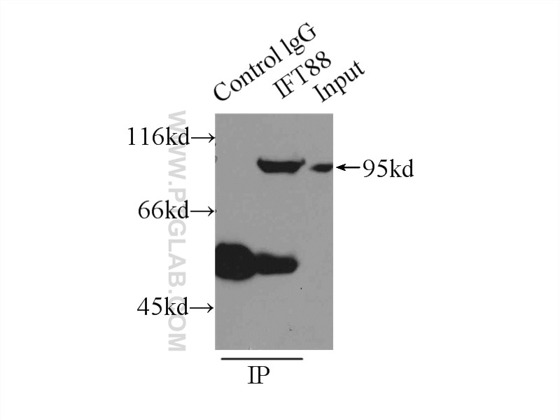 Immunoprecipitation (IP) experiment of HEK-293 cells using IFT88 Polyclonal antibody (13967-1-AP)