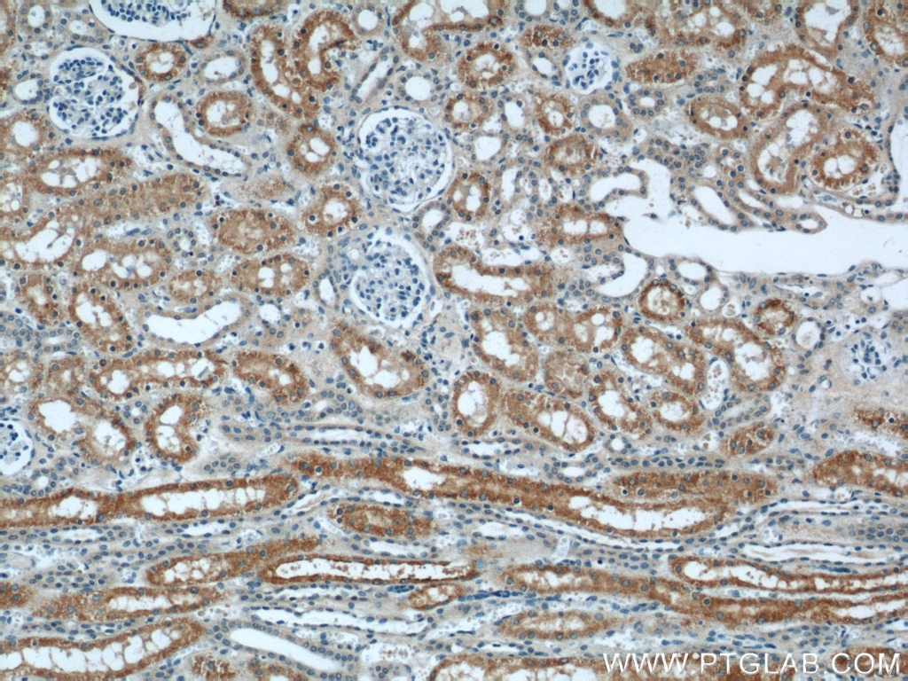 Immunohistochemistry (IHC) staining of human kidney tissue using IFT88 Monoclonal antibody (60227-1-Ig)