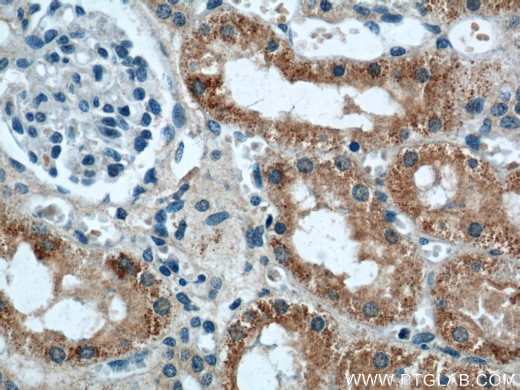 Immunohistochemistry (IHC) staining of human kidney tissue using IFT88 Monoclonal antibody (60227-1-Ig)