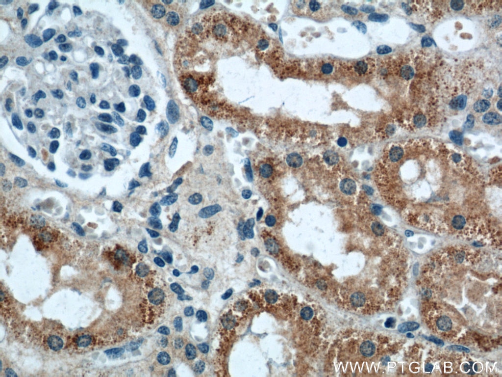 IHC staining of human kidney using 60227-1-Ig