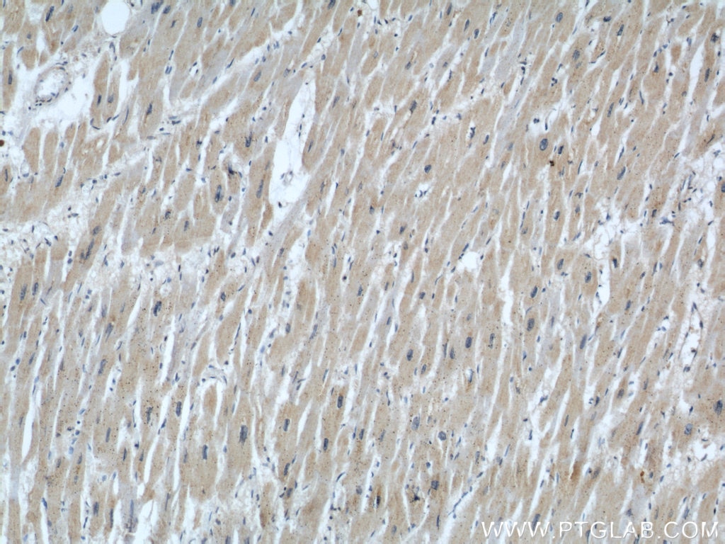 Immunohistochemistry (IHC) staining of human heart tissue using IFT88 Monoclonal antibody (60227-1-Ig)