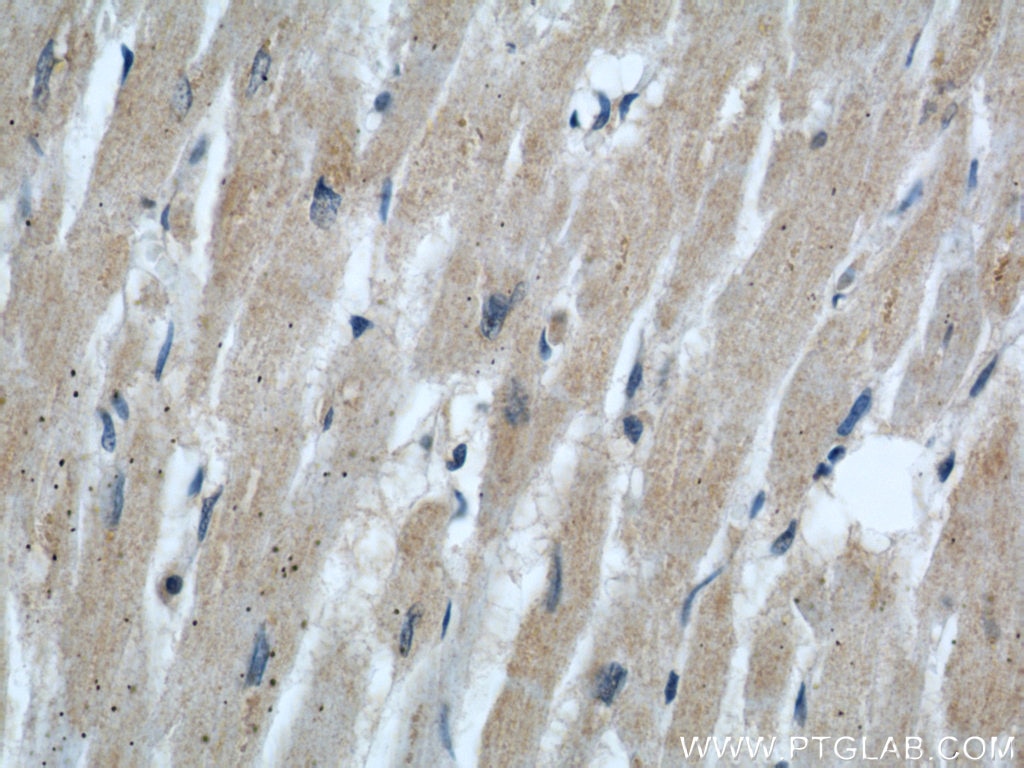 IHC staining of human heart using 60227-1-Ig