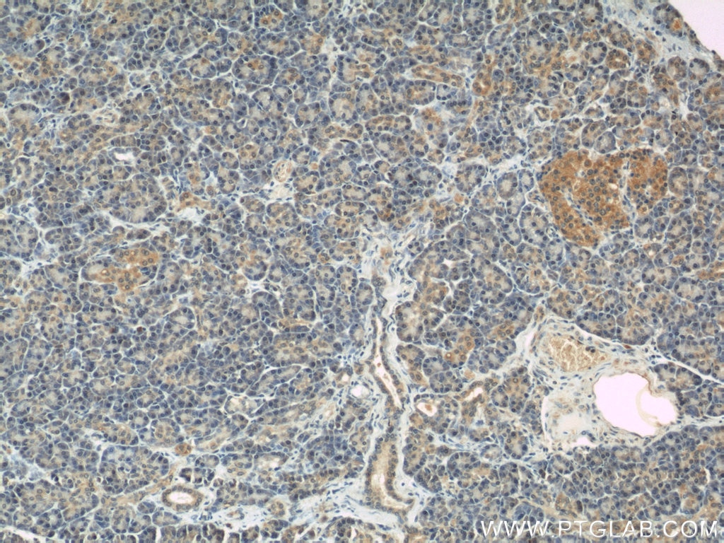 Immunohistochemistry (IHC) staining of human pancreas tissue using IFT88 Monoclonal antibody (60227-1-Ig)