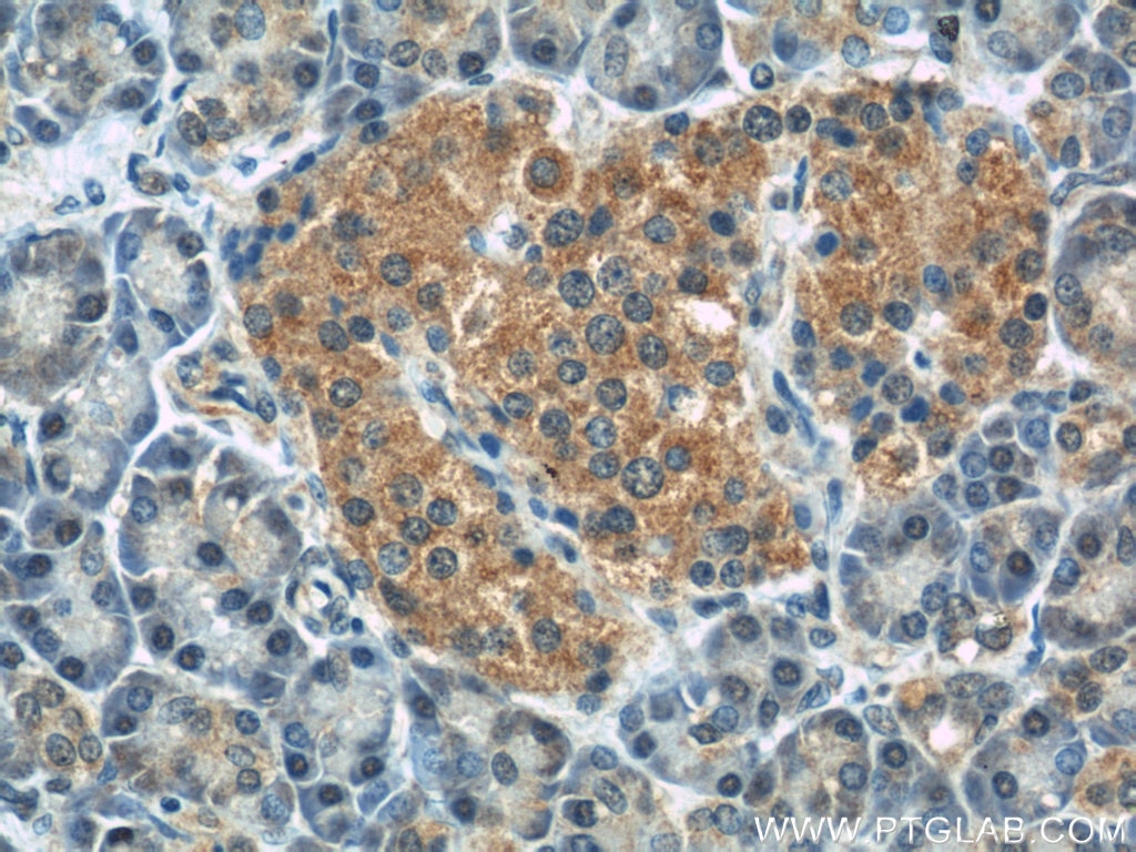 Immunohistochemistry (IHC) staining of human pancreas tissue using IFT88 Monoclonal antibody (60227-1-Ig)