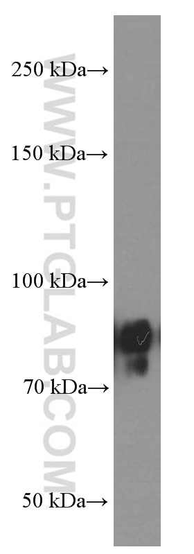 Western Blot (WB) analysis of human testis tissue using IFT88 Monoclonal antibody (60227-1-Ig)