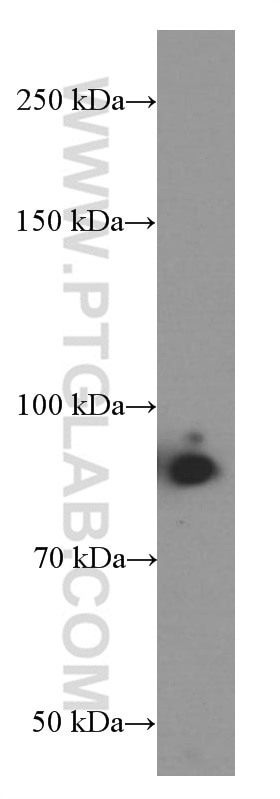 Western Blot (WB) analysis of NCCIT cells using IFT88 Monoclonal antibody (60227-1-Ig)