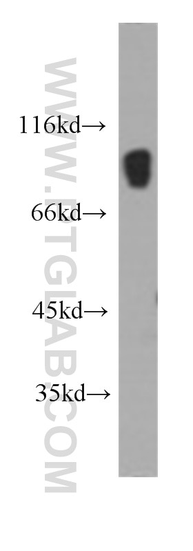 Western Blot (WB) analysis of human testis tissue using IFT88 Monoclonal antibody (60227-1-Ig)