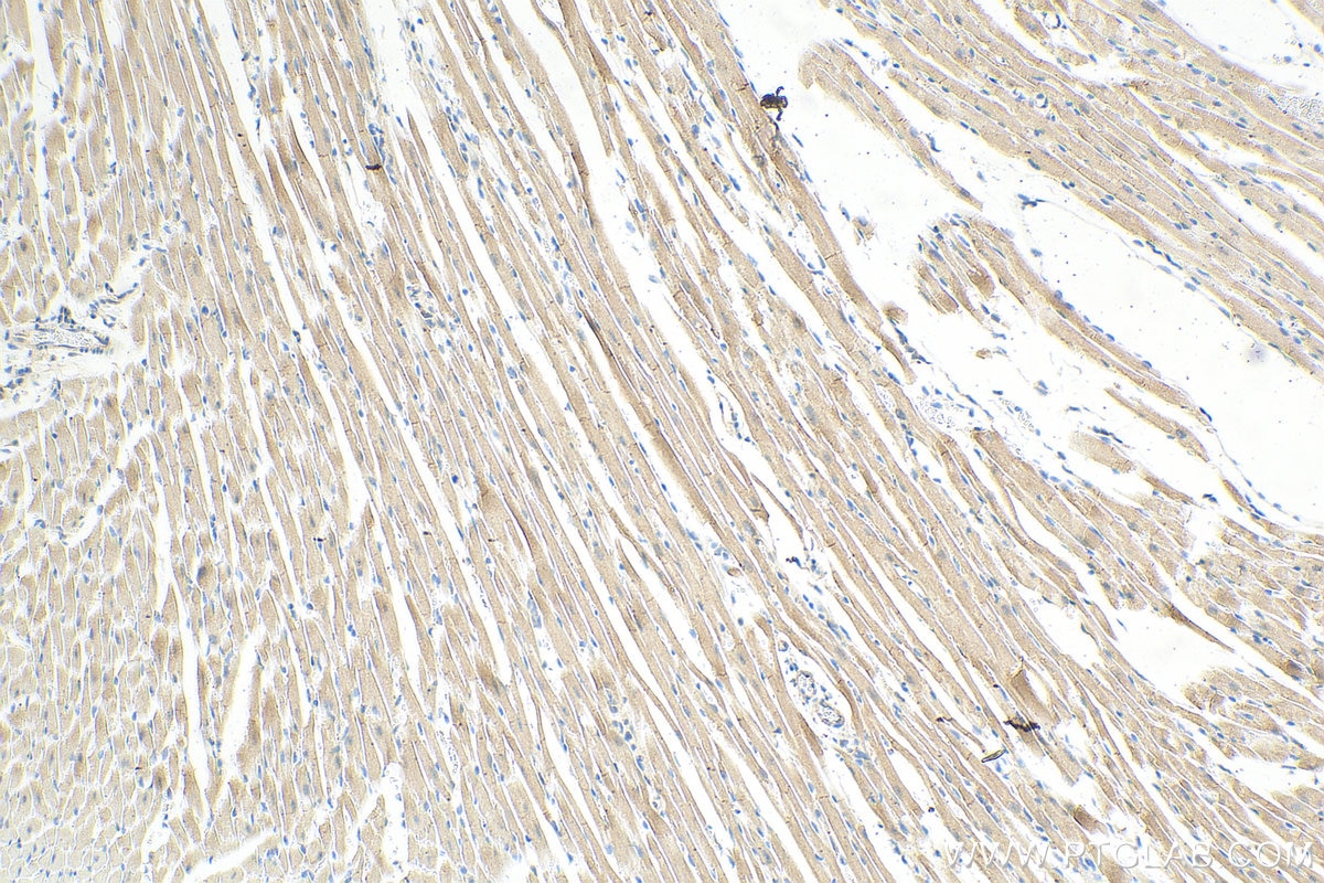 Immunohistochemistry (IHC) staining of mouse heart tissue using IFT88 Recombinant antibody (82886-1-RR)