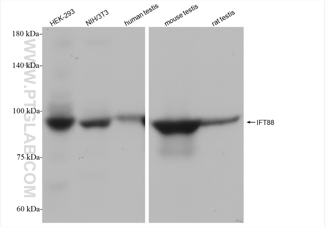 Western Blot (WB) analysis of various lysates using IFT88 Recombinant antibody (82886-1-RR)