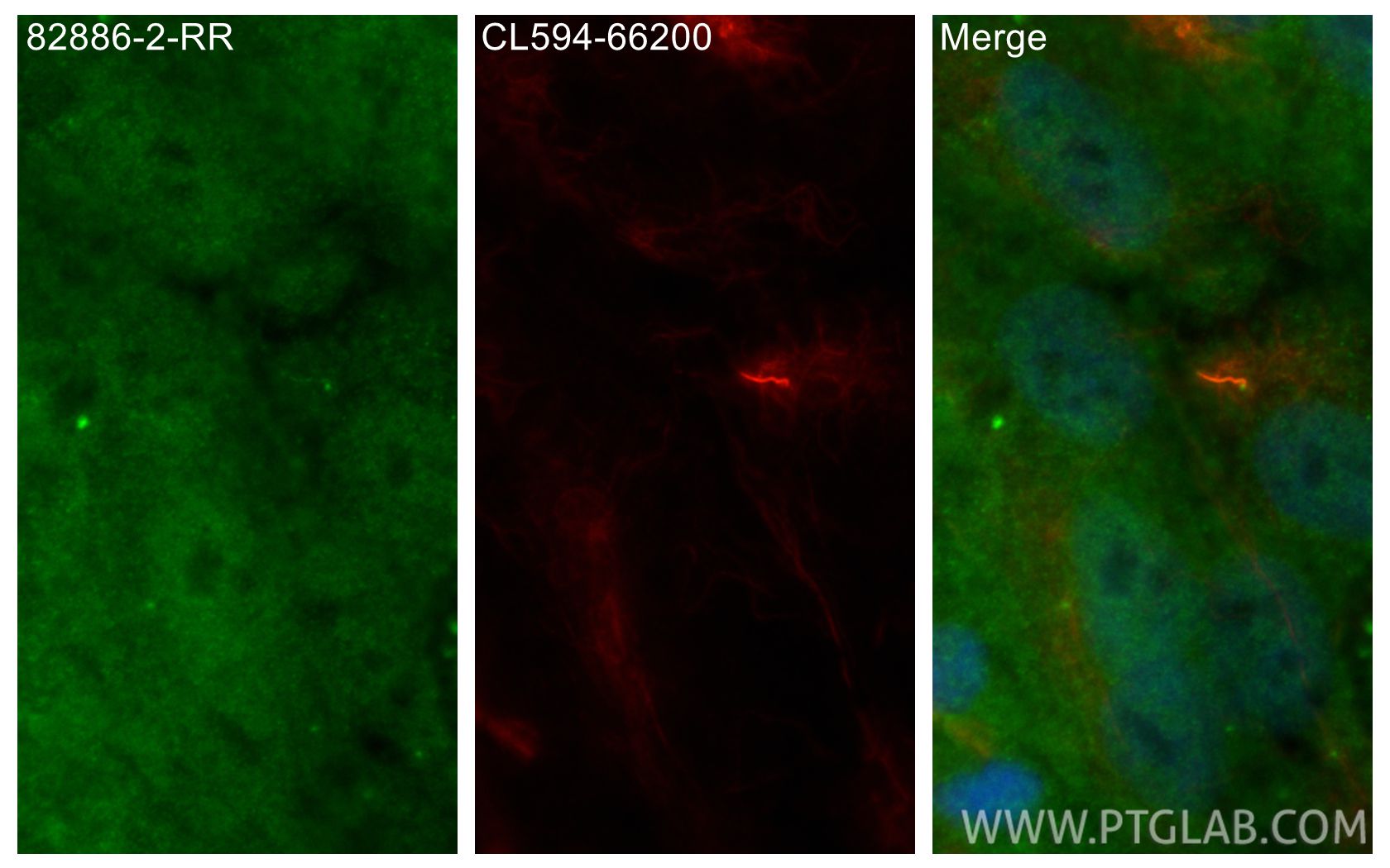 IF Staining of hTERT-RPE1 using 82886-2-RR (same clone as 82886-2-PBS) Immunofluorescence (IF) / fluorescent staining of hTERT-RPE1 cells using IFT88 Recombinant monoclonal antibody (82886-2-RR)